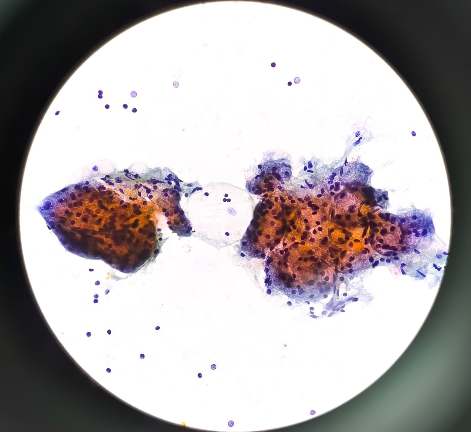 View of Expert Cytopathology Services in Texas | Comprehensive Diagnostic Testing